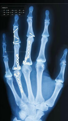 i hope i don&#39;t murder me, i hope i don&#39;t burden you